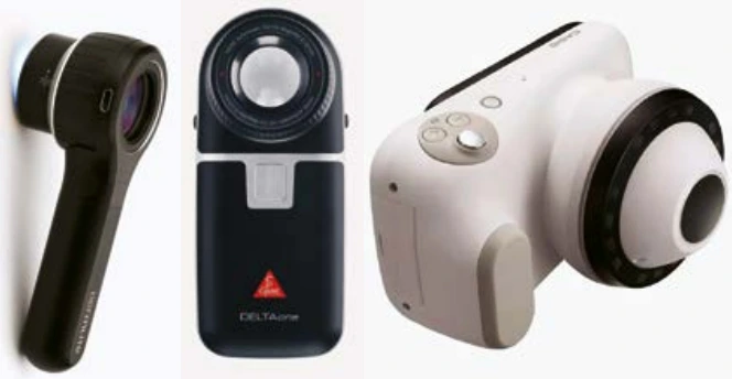 Dermoscopes. À gauche Dermlite DL4, au centre Heine Delta One,à droite Casio DZ-100