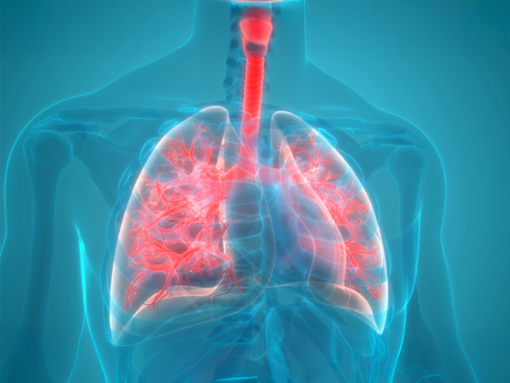 7 points clés : Vous avez dit exacerbation ? 