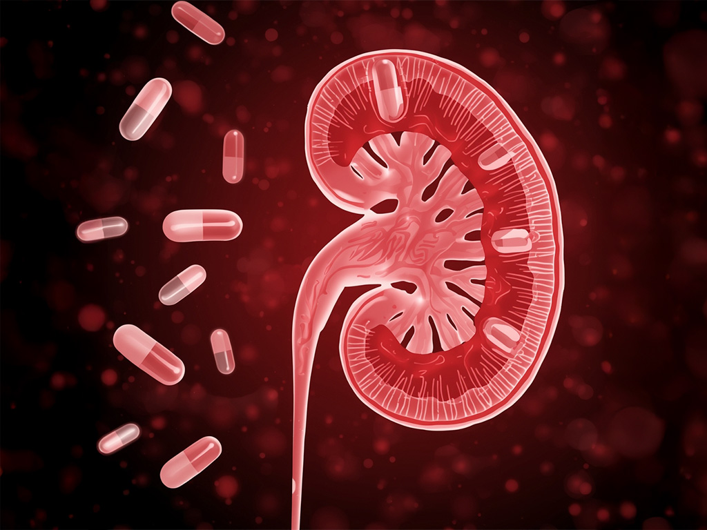 Néphrotoxicité médicamenteuse : mettre à jour ses pratiques pour protéger le rein de ses patients